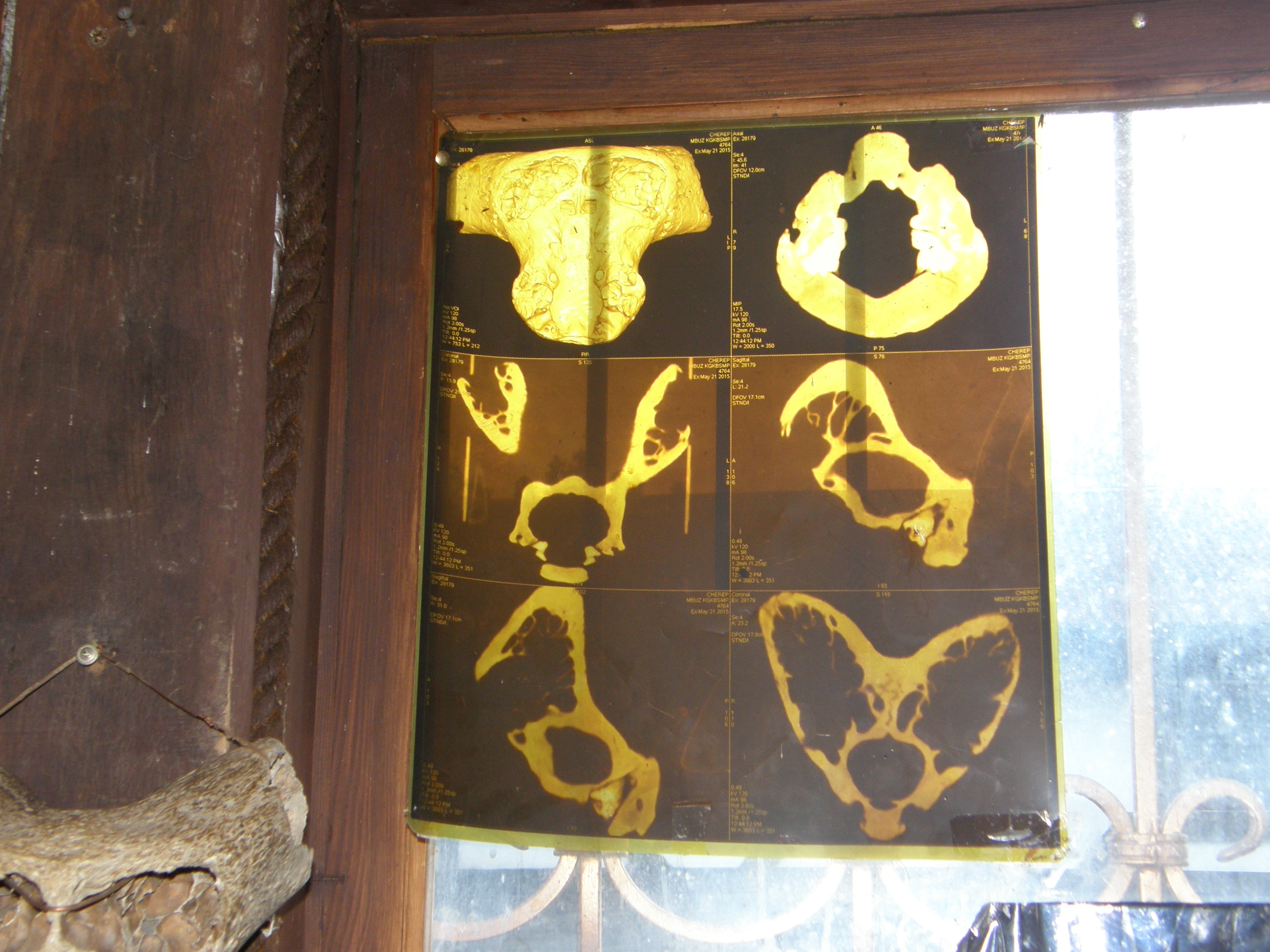 EKB-muzej Panoptikum-tomografija lubanje nepoznatog bića